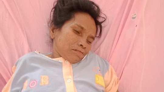 RFL SAYA SELAMAT: Miss X Alias Yenti Dirawat di RS Yarsi-Ibnu Sina Simpang Empat